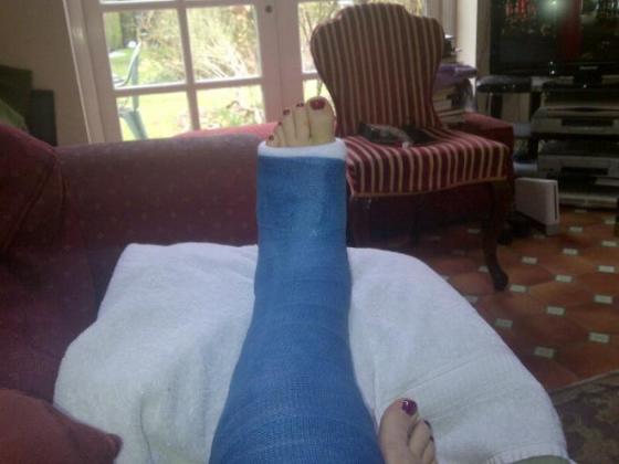 Julie's broken ankle